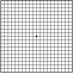 加齢黄斑変性症 正常な見え方
