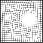 加齢黄斑変性症 部分的に欠ける